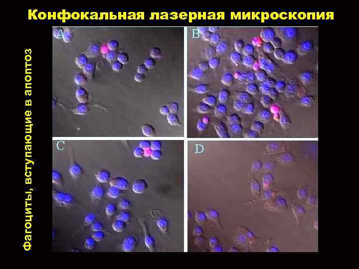 Фагоциты, вступающие в апоптоз Конфокальная лазерная микроскопия 