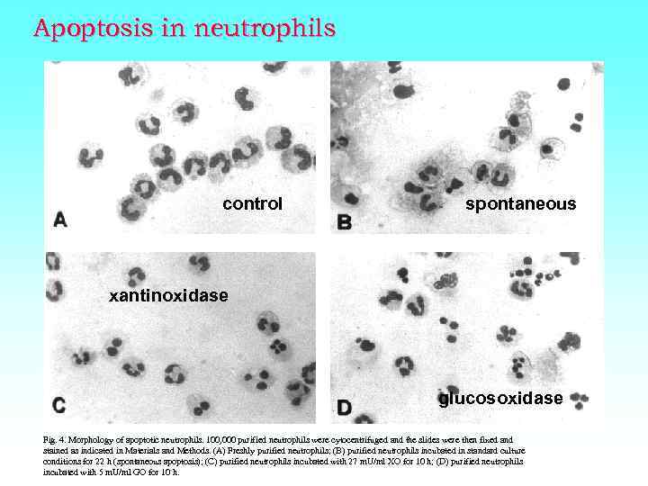 Apoptosis in neutrophils control spontaneous xantinoxidase glucosoxidase Fig. 4. Morphology of apoptotic neutrophils. 100,