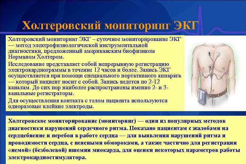 Холтеровский мониторинг ЭКГ – суточное мониторирование ЭКГ — метод электрофизиологической инструментальной диагностики, предложенный американским