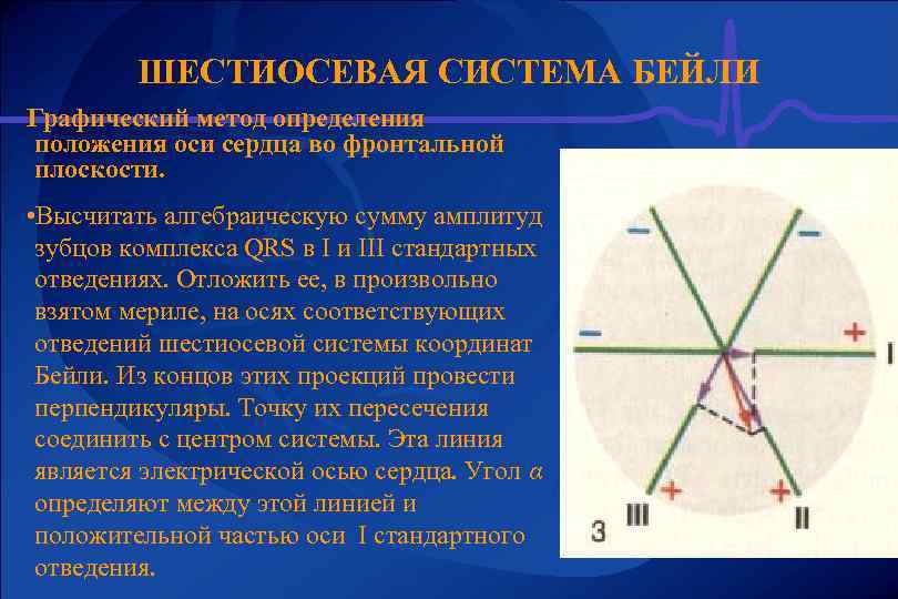 Ось определение. Шестиосевая система отведений по Бейли. Электрическая ось Бейли. Шестиосевая система отведений (координат) по Бейли. Графический метод определения оси сердца.