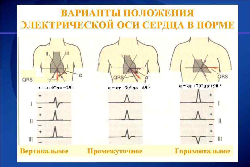 Эос экг картинки