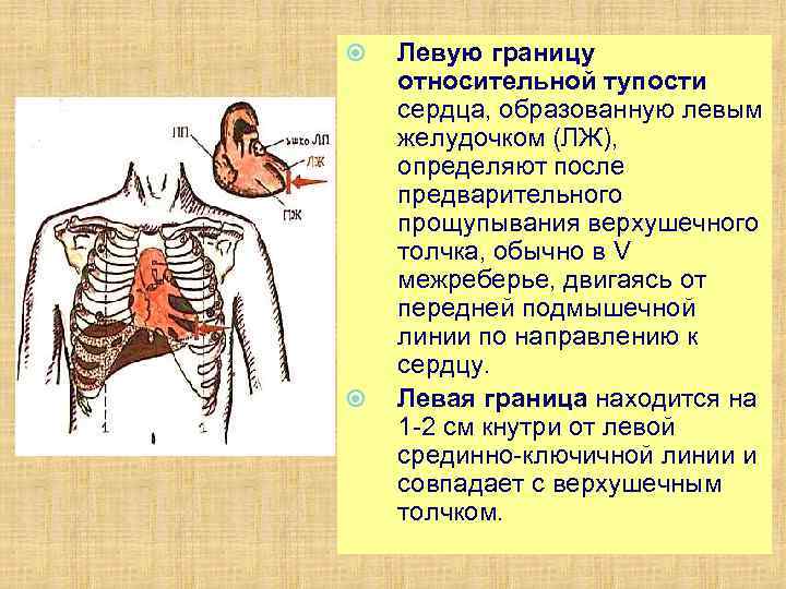  Левую границу относительной тупости сердца, образованную левым желудочком (ЛЖ), определяют после предварительного прощупывания