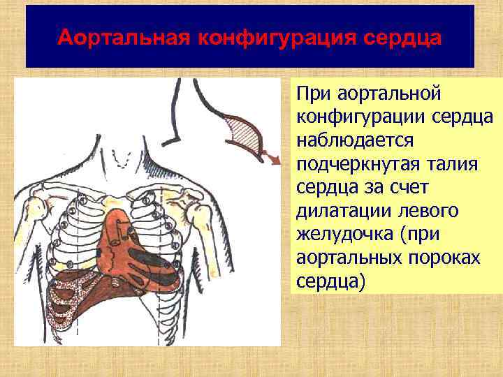 Нормальная конфигурация сердца рисунок