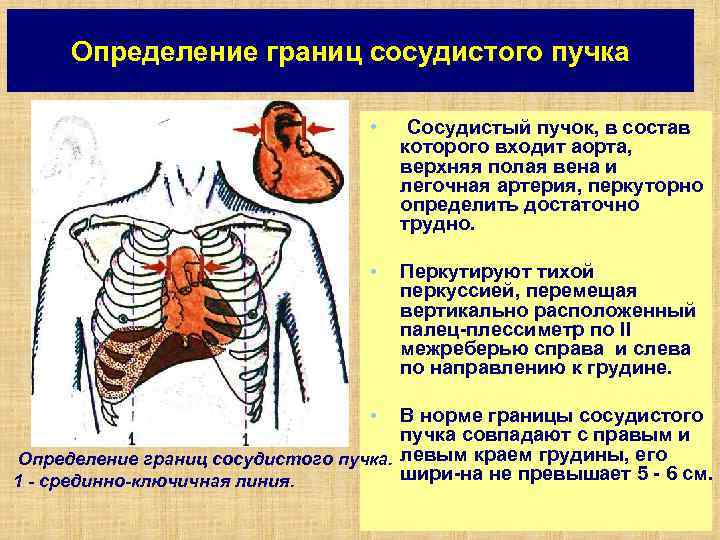 Определение границ сосудистого пучка • Сосудистый пучок, в состав • Перкутируют тихой перкуссией, перемещая