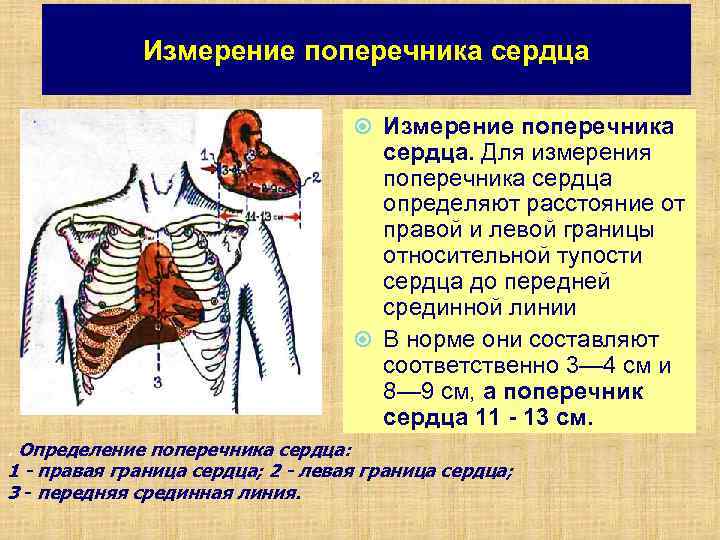 Измерение поперечника сердца Измерение поперечника сердца. Для измерения поперечника сердца определяют расстояние от правой