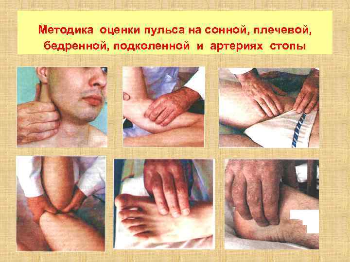 Методика оценки пульса на сонной, плечевой, бедренной, подколенной и артериях стопы 
