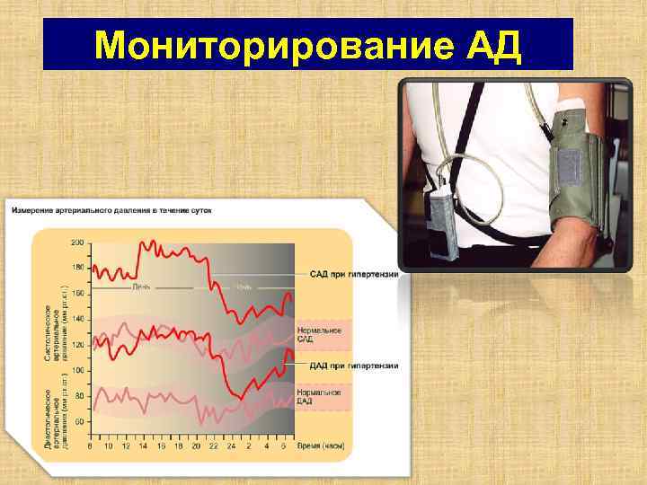 Мониторирование АД 