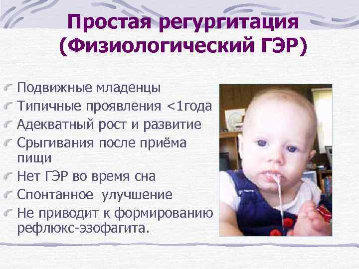 Простая регургитация (Физиологический ГЭР) Подвижные младенцы Типичные проявления <1 года Адекватный рост и развитие
