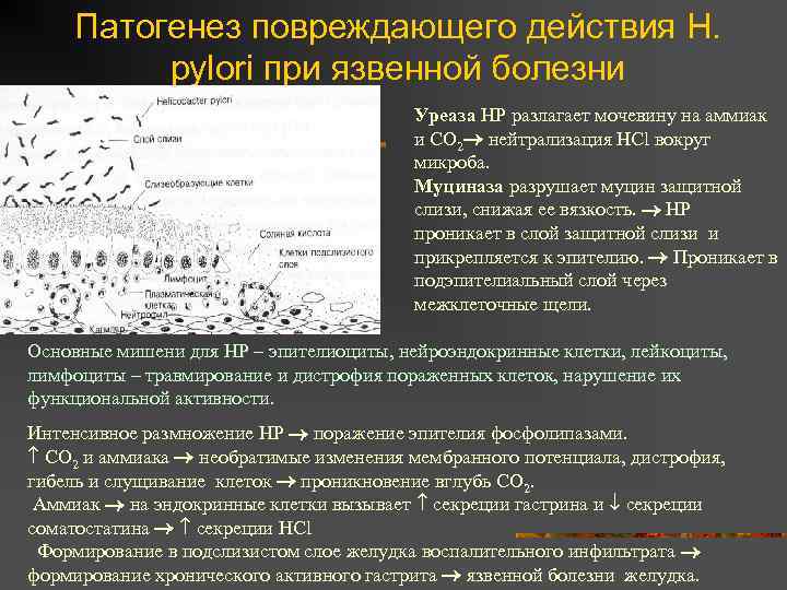 Патогенез повреждающего действия H. pylori при язвенной болезни Уреаза НР разлагает мочевину на аммиак