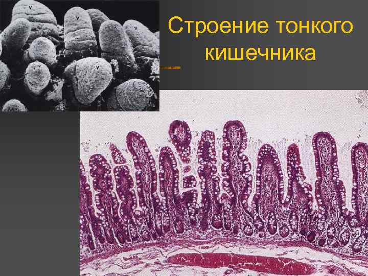 Строение тонкого кишечника 