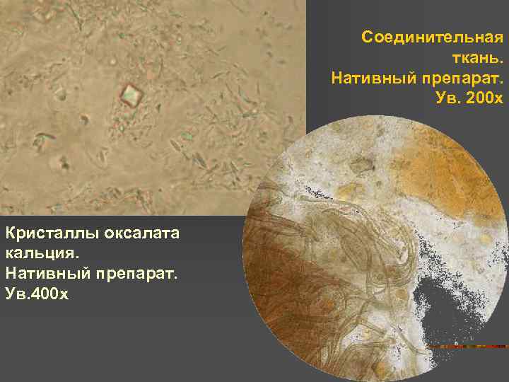 Соединительная ткань. Нативный препарат. Ув. 200 х Кристаллы оксалата кальция. Нативный препарат. Ув. 400