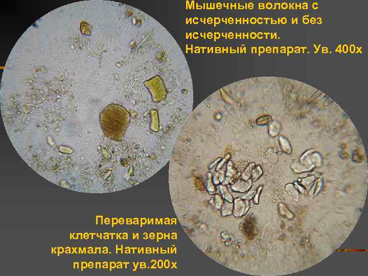 Мышечные волокна с исчерченностью и без исчерченности. Нативный препарат. Ув. 400 х Переваримая клетчатка