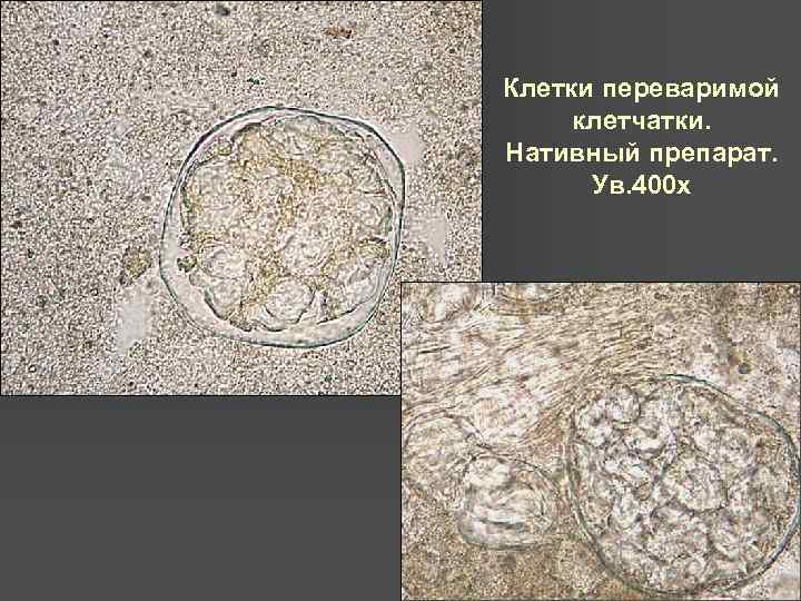 Клетки переваримой клетчатки. Нативный препарат. Ув. 400 х 