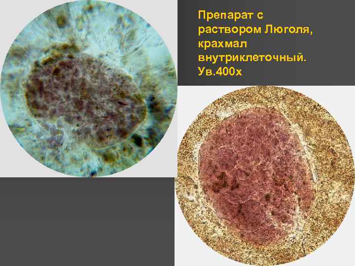 Препарат с раствором Люголя, крахмал внутриклеточный. Ув. 400 х 