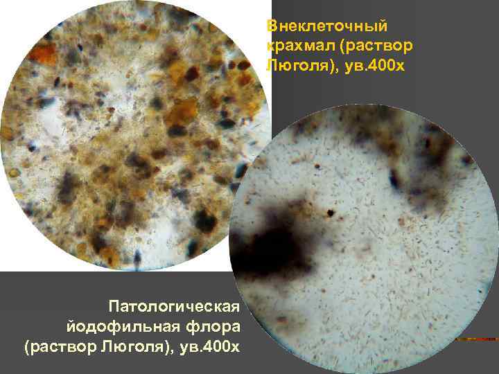 Бактерии в копрограмме. Микроскопия кала растительная клетчатка непереваримая. Копрология кала микроскопия.