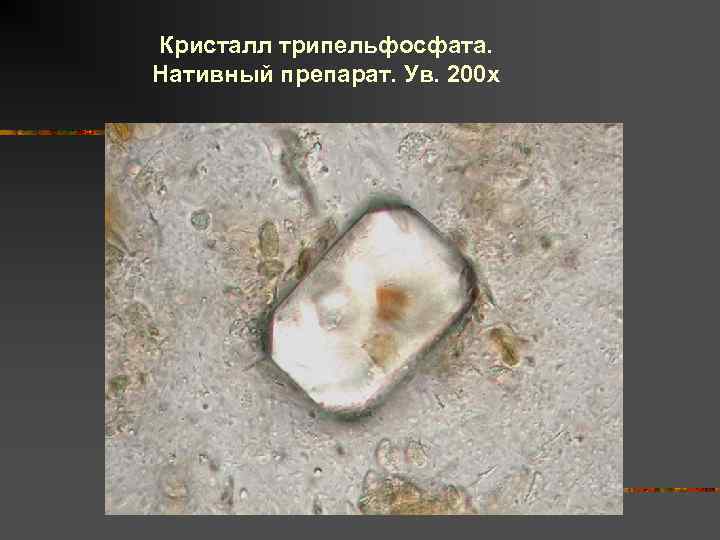 Кристалл трипельфосфата. Нативный препарат. Ув. 200 х 