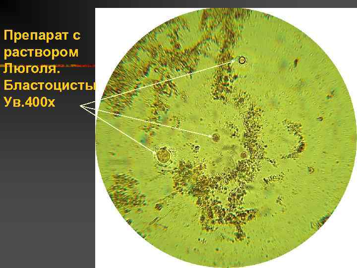 Препарат с раствором Люголя. Бластоцисты Ув. 400 х 