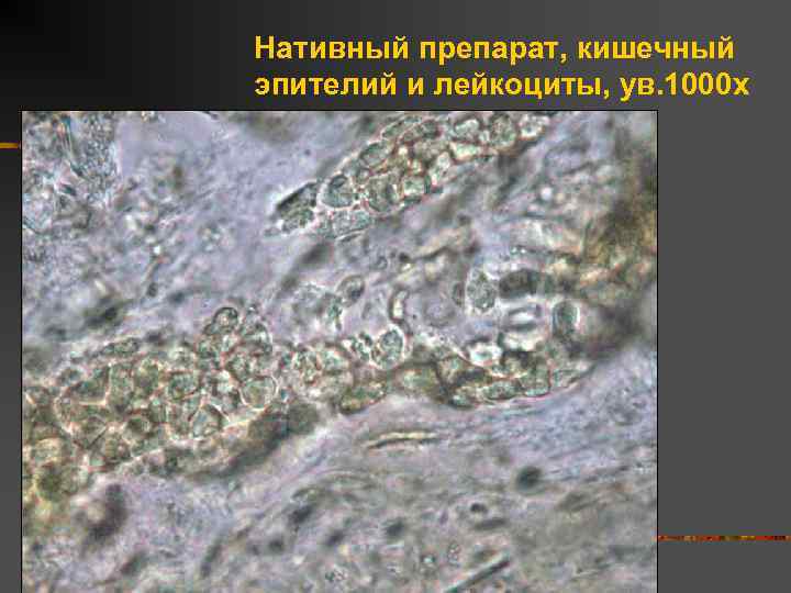 Нативный препарат, кишечный эпителий и лейкоциты, ув. 1000 х 