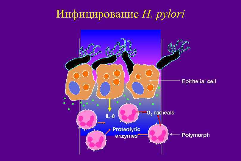 Инфицирование H. pylori Epithelial cell IL-8 Proteolytic enzymes HP 98 /NK/5 2/1/2018 O 2