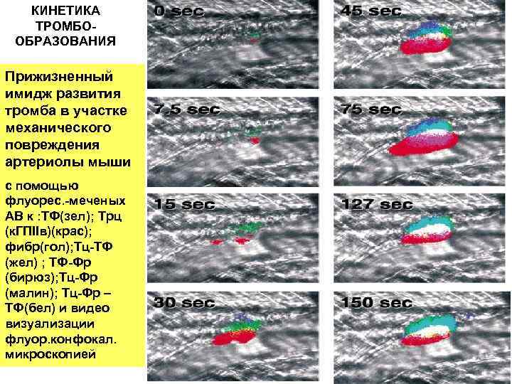 КИНЕТИКА ТРОМБО- ОБРАЗОВАНИЯ Прижизненный имидж развития тромба в участке механического повреждения артериолы мыши с