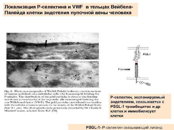Локализация Р-селектина и VWF в тельцах Вейбела. Палейда клетки эндотелия пупочной вены человека Р-селектин,