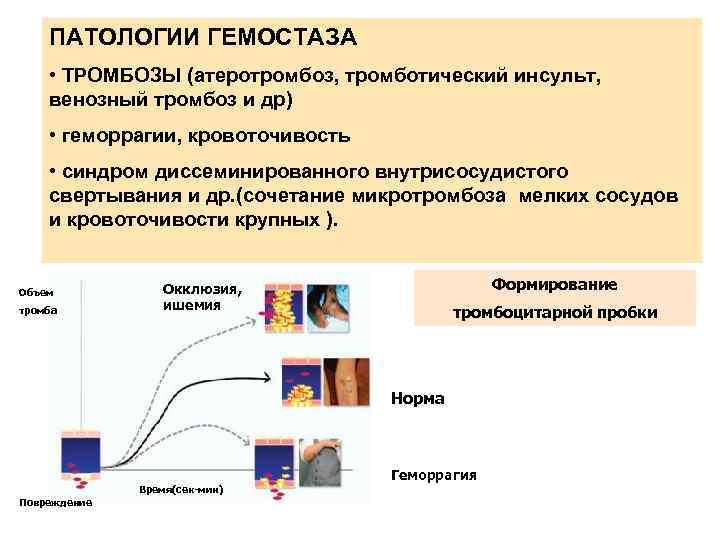ПАТОЛОГИИ ГЕМОСТАЗА • ТРОМБОЗЫ (атеротромбоз, тромботический инсульт, венозный тромбоз и др) • геморрагии, кровоточивость
