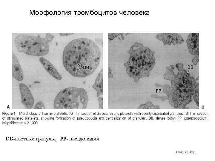 Морфология тромбоцитов человека DB-плотные гранулы, РР- псевдоподии 2005 