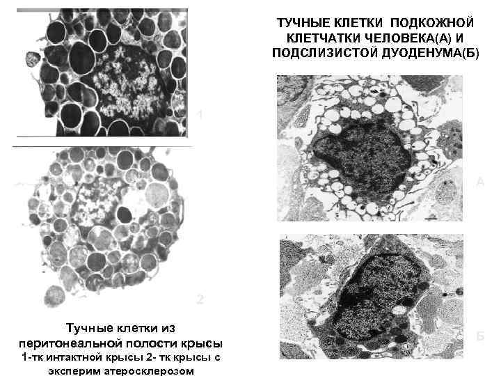 ТУЧНЫЕ КЛЕТКИ ПОДКОЖНОЙ КЛЕТЧАТКИ ЧЕЛОВЕКА(А) И ПОДСЛИЗИСТОЙ ДУОДЕНУМА(Б) 1 А 2 Тучные клетки из