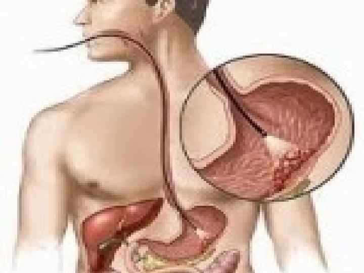  Литература: http: //zdorovja. com. ua/content/view/481/180/ http: //www. lood. ru/o/o-klizma. html С. А. Мухина,