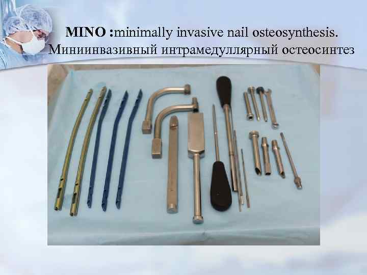 MINO : minimally invasive nail osteosynthesis. Миниинвазивный интрамедуллярный остеосинтез 