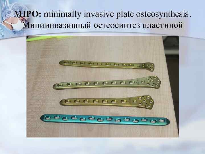 MIPO: minimally invasive plate osteosynthesis. Миниинвазивный остеосинтез пластиной 