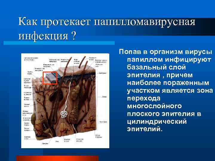 Как протекает папилломавирусная инфекция ? Попав в организм вирусы папиллом инфицируют базальный слой эпителия
