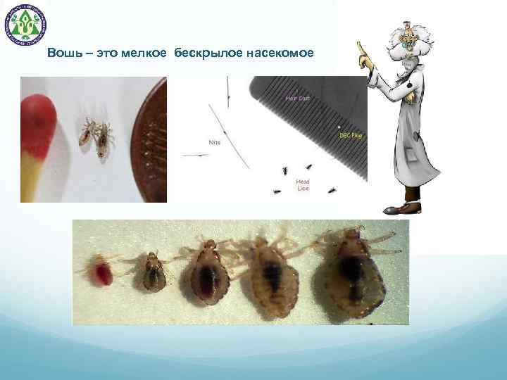Вошь – это мелкое бескрылое насекомое 