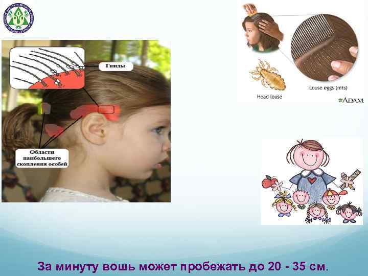 За минуту вошь может пробежать до 20 - 35 см. 