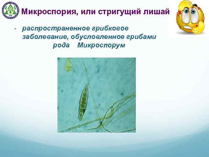 Микроспория, или стригущий лишай - распространенное грибковое заболевание, обусловленное грибами рода Микроспорум 