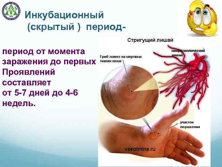 Инкубационный (скрытый ) период от момента заражения до первых Проявлений составляет от 5 -7