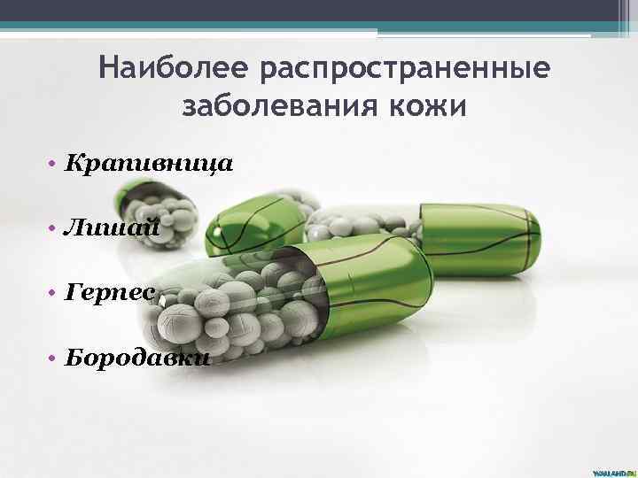 Наиболее распространенные заболевания кожи • Крапивница • Лишай • Герпес • Бородавки 