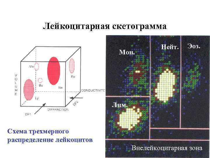    Лейкоцитарная скетограмма    Нейт.  Эоз.   
