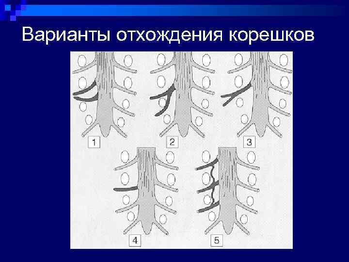 Варианты отхождения корешков 