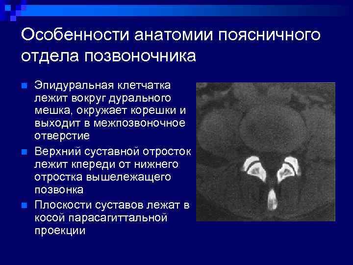 Особенности анатомии поясничного отдела позвоночника n n n Эпидуральная клетчатка лежит вокруг дурального мешка,