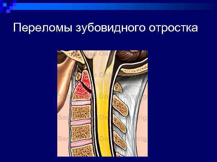 Где можно сделать компьютерную томографию позвоночника в москве