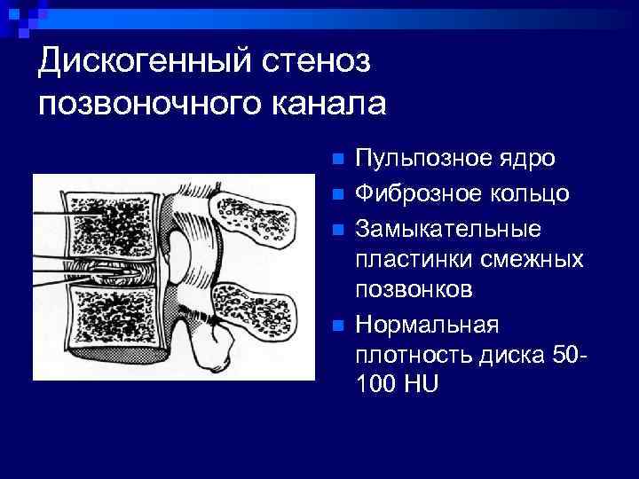 Компьютерная томография позвоночника как проводится видео