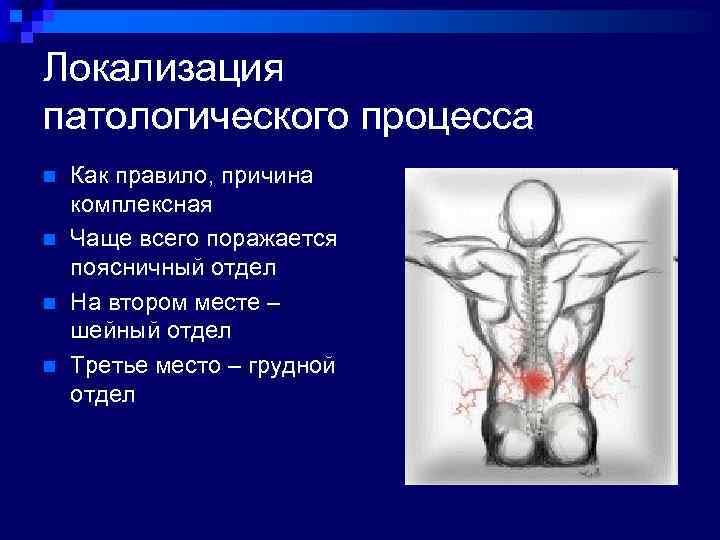 Локализация патологического процесса n n Как правило, причина комплексная Чаще всего поражается поясничный отдел