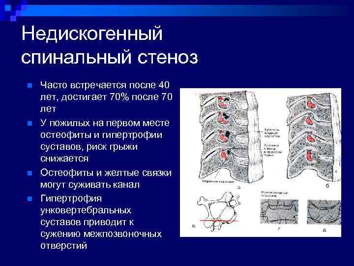 Мр картина дистрофических изменений