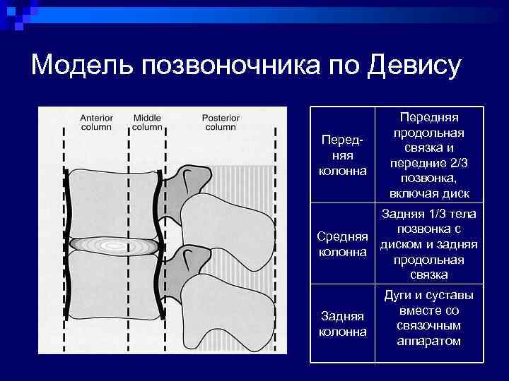 Модель позвоночника по Девису Передняя колонна Передняя продольная связка и передние 2/3 позвонка, включая