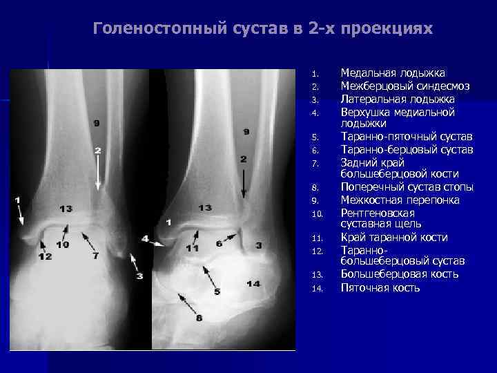 Голеностопный сустав в 2 -х проекциях 1. 2. 3. 4. 5. 6. 7. 8.