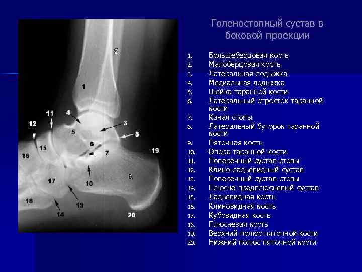 Голеностопный сустав в боковой проекции 1. 2. 3. 4. 5. 6. 7. 8. 9.
