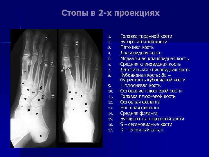 Стопы в 2 -х проекциях 1. 2. 3. 4. 5. 6. 7. 8. 9.