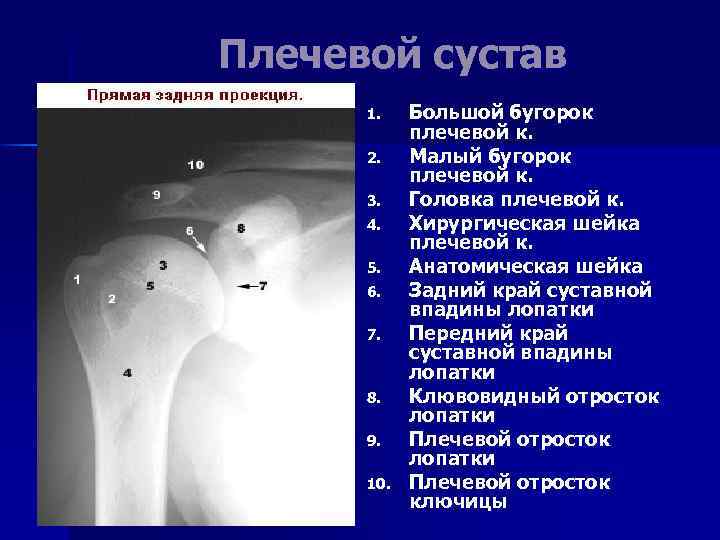 Плечевой сустав 1. 2. 3. 4. 5. 6. 7. 8. 9. 10. Большой бугорок