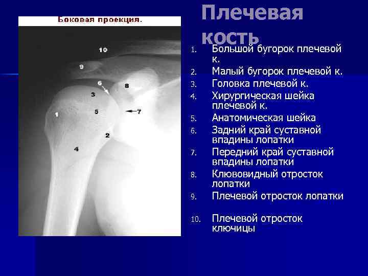 1. Плечевая костьбугорок плечевой Большой 2. 3. 4. 5. 6. 7. 8. 9. 10.
